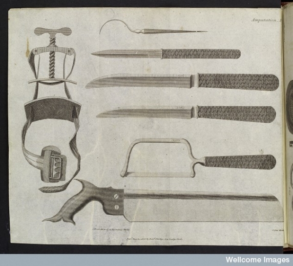 еще о врачебной теме 19го столетия. Хирургия. (Фото 23)