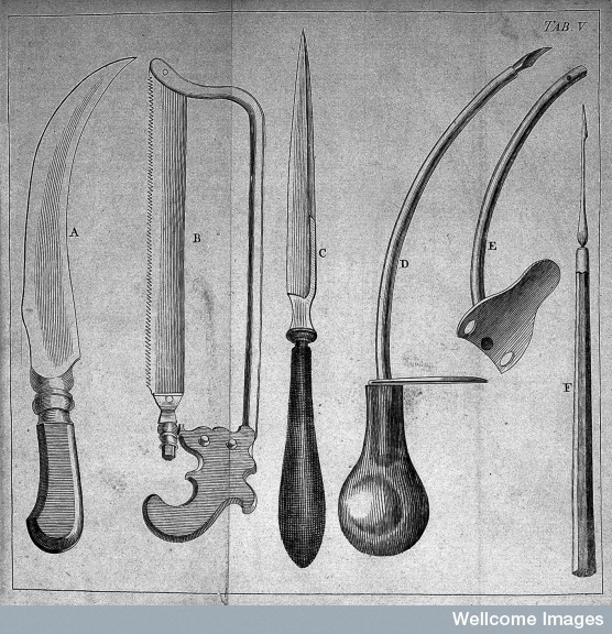 еще о врачебной теме 19го столетия. Хирургия. (Фото 22)