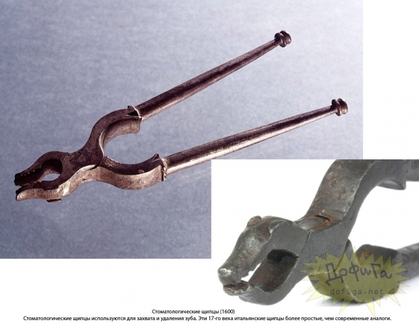 Зубодерные инструменты старых времен (Фото 3)